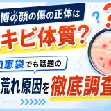 安野貴博の顔の傷の正体はニキビ体質？知恵袋でも話題の肌荒れ原因を徹底調査